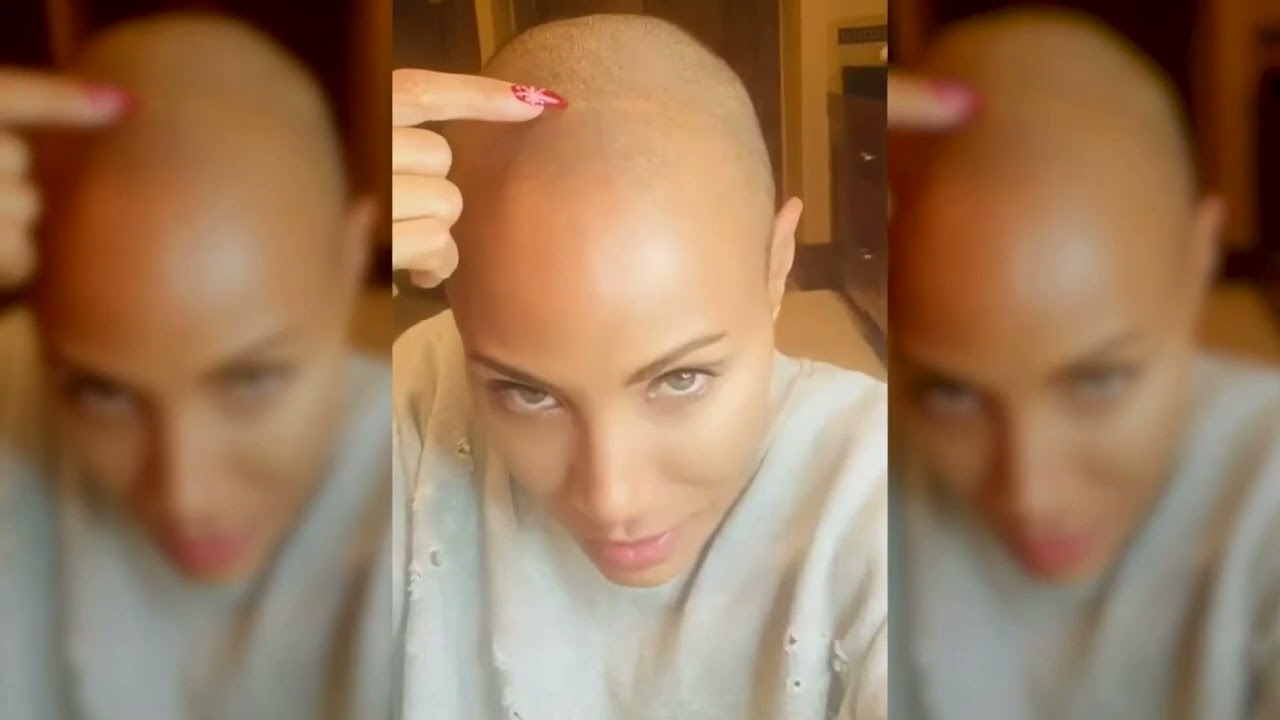 WATCH: Dr.Lam explaining alopecia after Will Smith Oscars controversy