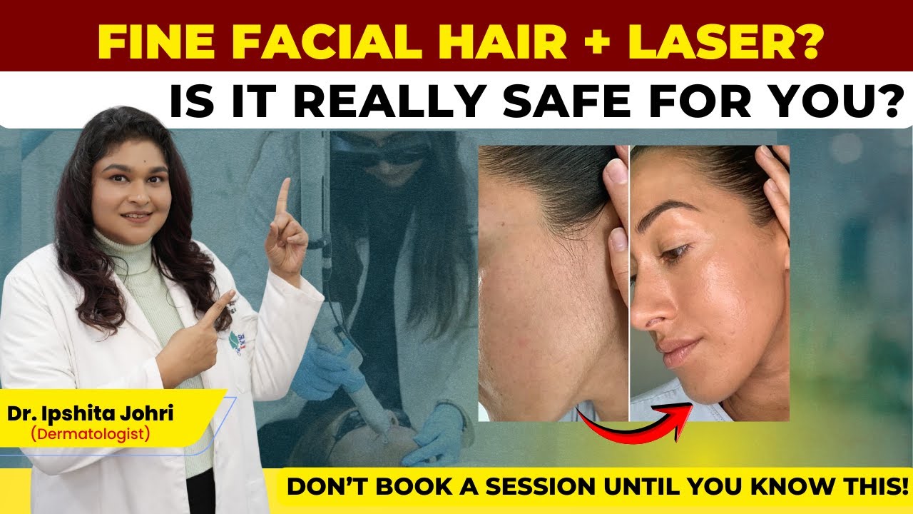 Thinking Laser for Fine Facial Hair? Watch This First | Skinfinity Derma