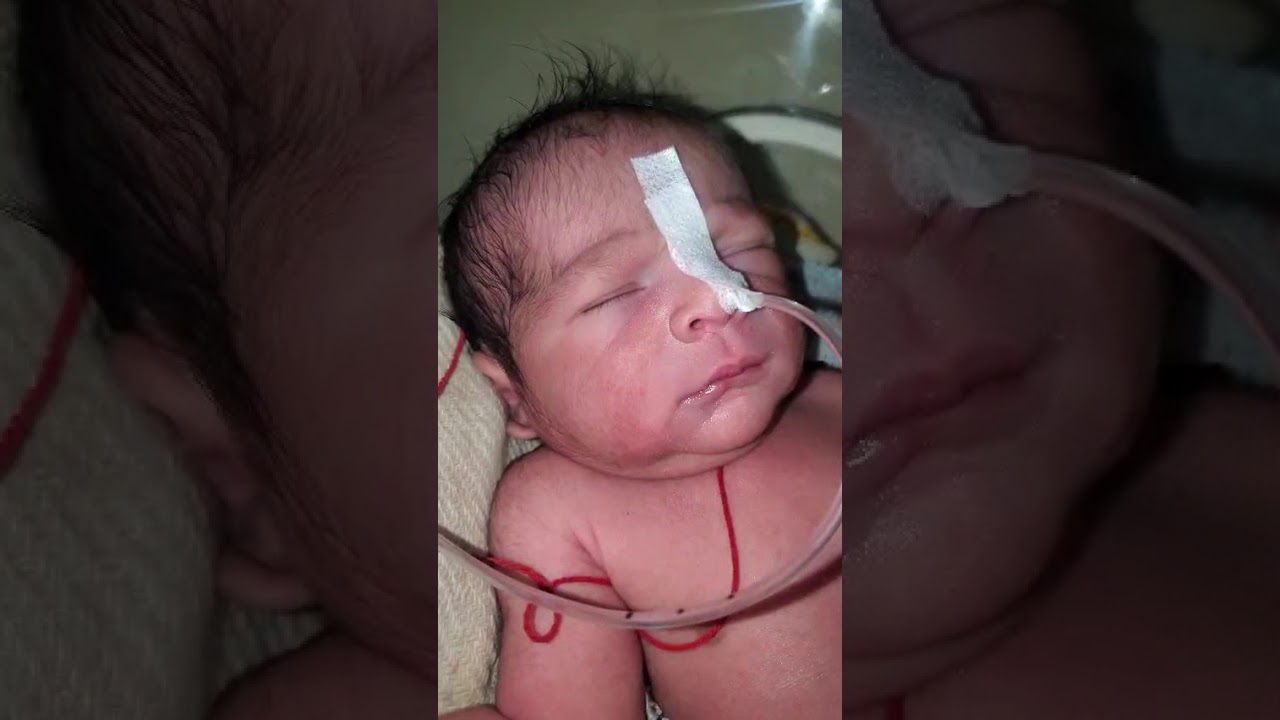 Oxygen has been started for the newborn baby because he/she is having difficulty breathing