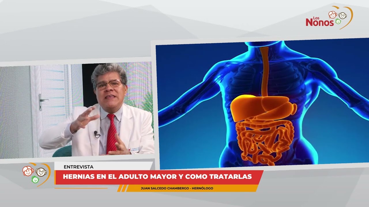 Hernias en el adulto mayor - entrevista - Los Nonos