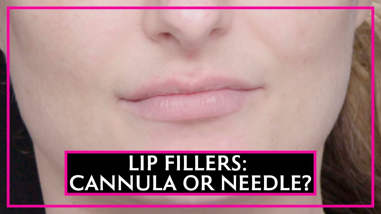 Lip Fillers: A Needle Or A Cannula?