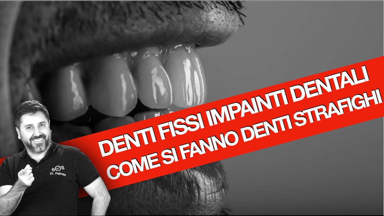 Dr Palmas: Dentista con migliaia di casi risolti mostra come fare ad avere denti strafighi