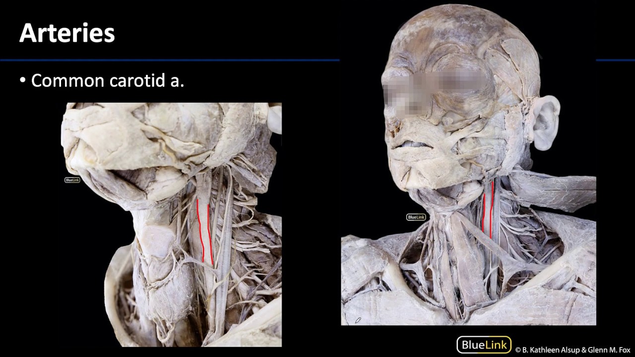 Anterior Neck - Arteries