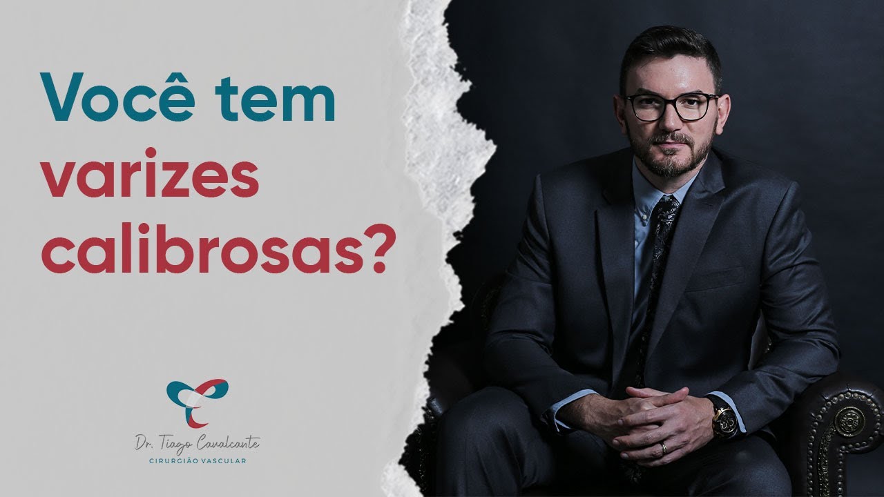 Melhor tratamento para veias grossas nas pernas