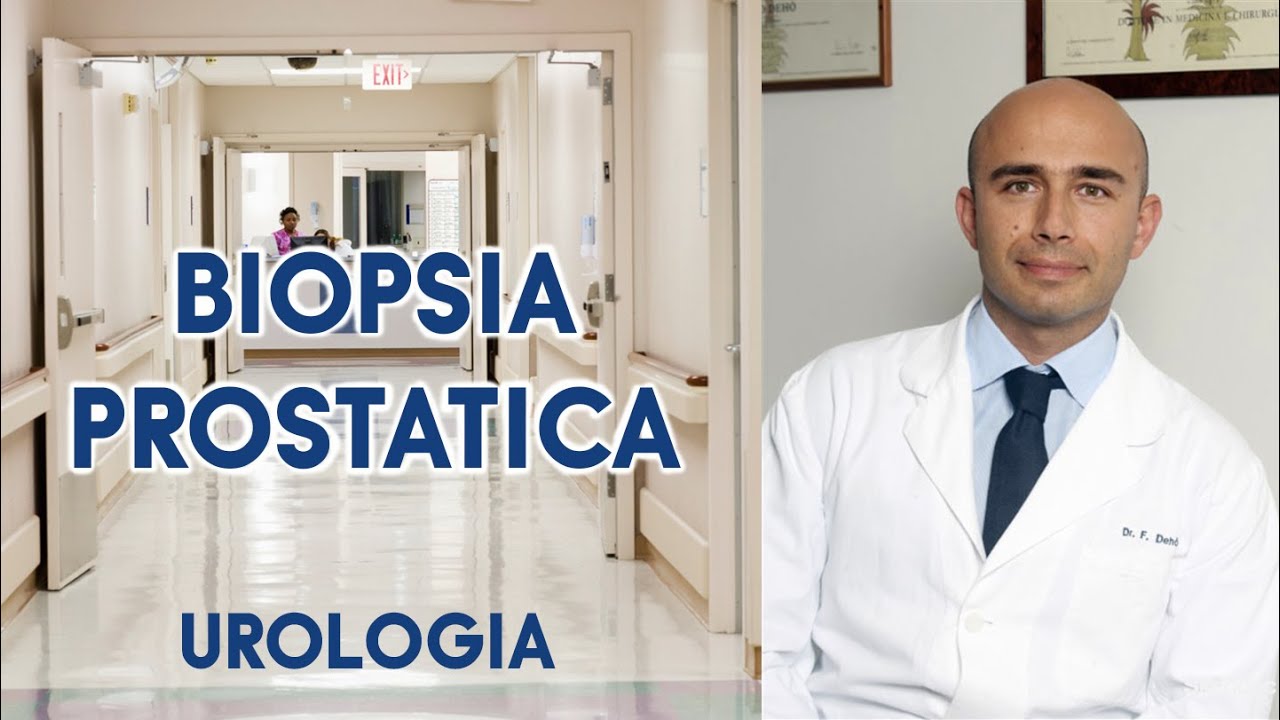 BIOPSIA PROSTATICA!!Come si effettua? Dott. Federico Dehò