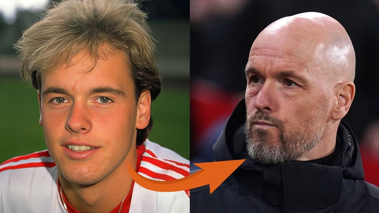 25+ Bald Footballers before they lost their hair