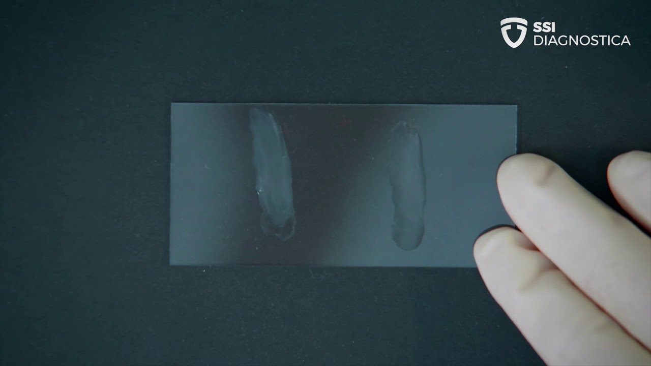 Salmonella Slide Agglutination
