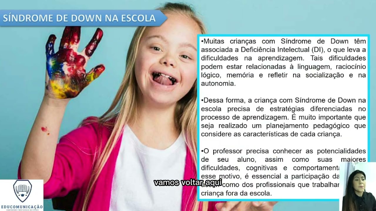 A Síndrome de Down - Educação Especial e Inclusiva