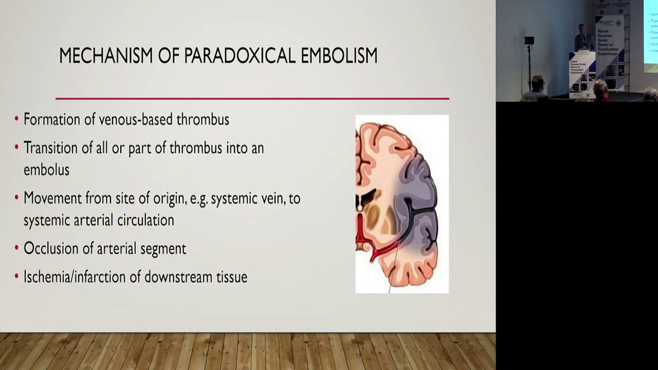 Prof. Dr. Alpay Çeliker | Patent Foramen Ovale A Part of Normal Human Physiology