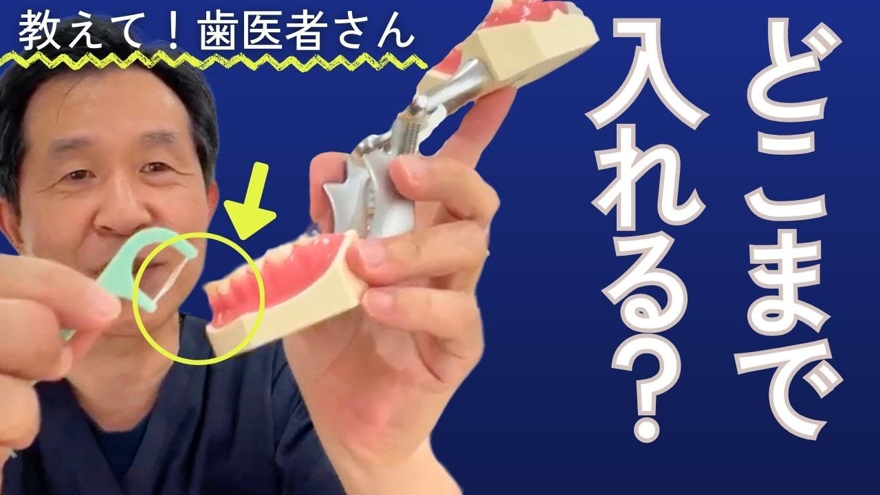 フロスは歯ぐきの溝まで入れるべき？歯医者が教える！！