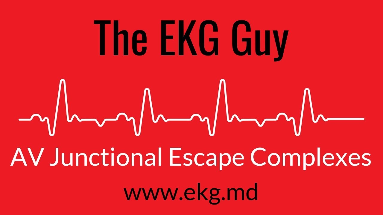 AV Junctional Escape Complexes EKG l The EKG Guy - www.ekg.md