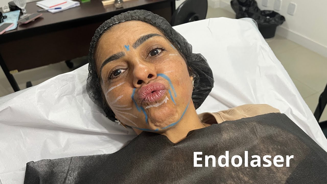 Patrícia Abud realizando tratamento com Endolaser