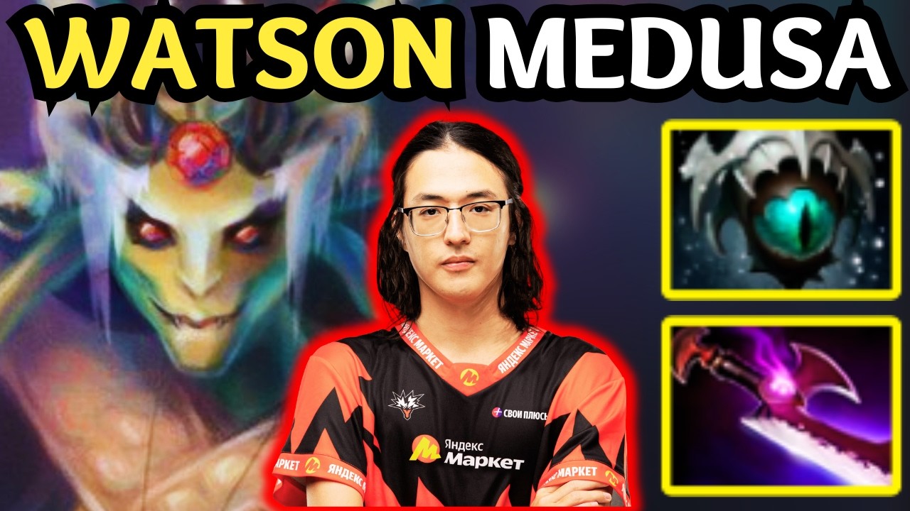 🔥 Rank 4 WATSON MEDUSA Carry — Insane Damage Insane Tank | Dota 2 🔥