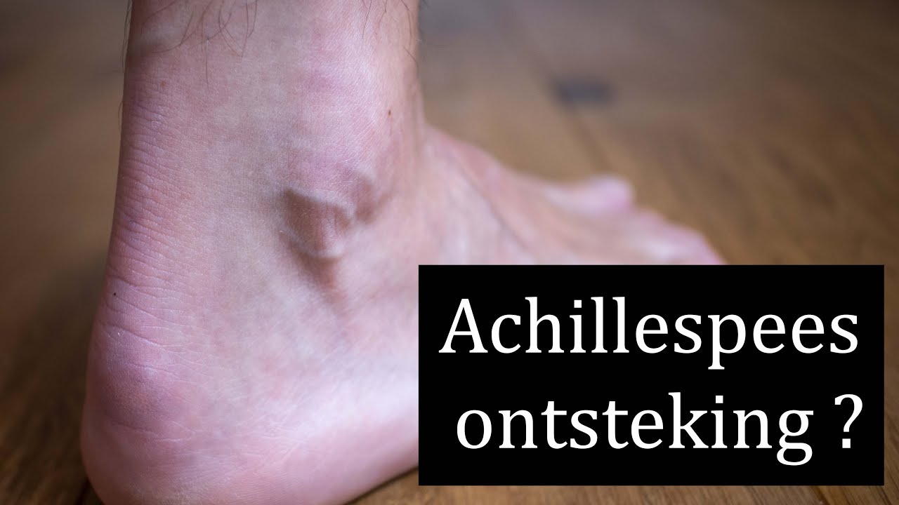 Wat kun je doen aan een pijnlijke achillespees?