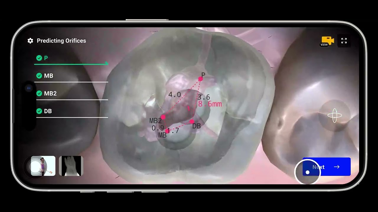 Dental EndoMaster Guide
