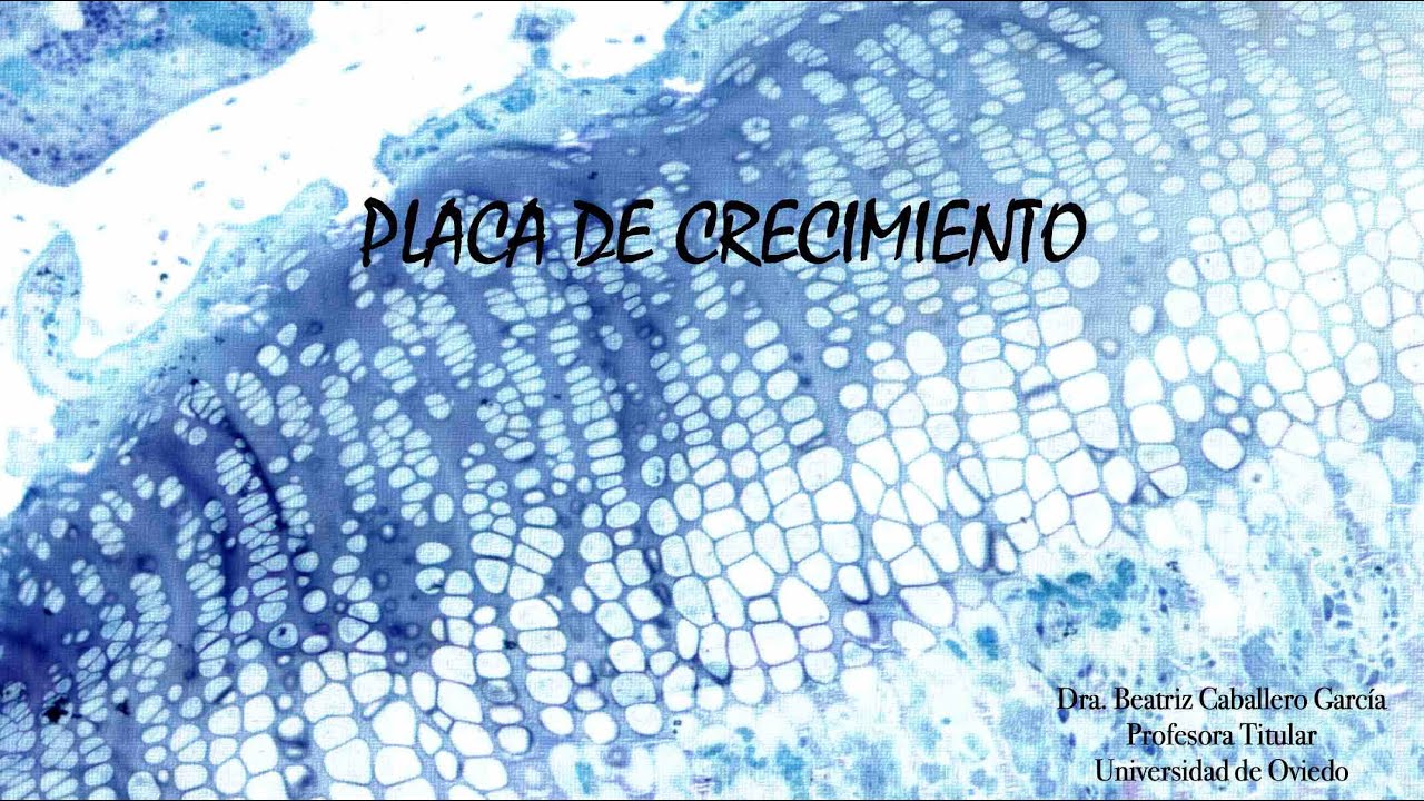 Placa de crecimiento (Azul de Toluidina)