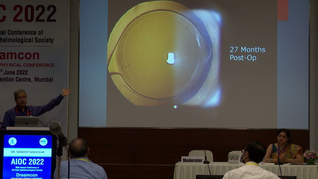 AIOC2022 GP82 topic Dr  SANDEEP NAGVEKAR Preop Astigmatism 1 0 D Toric Multifocal vs MFIOL with LRI