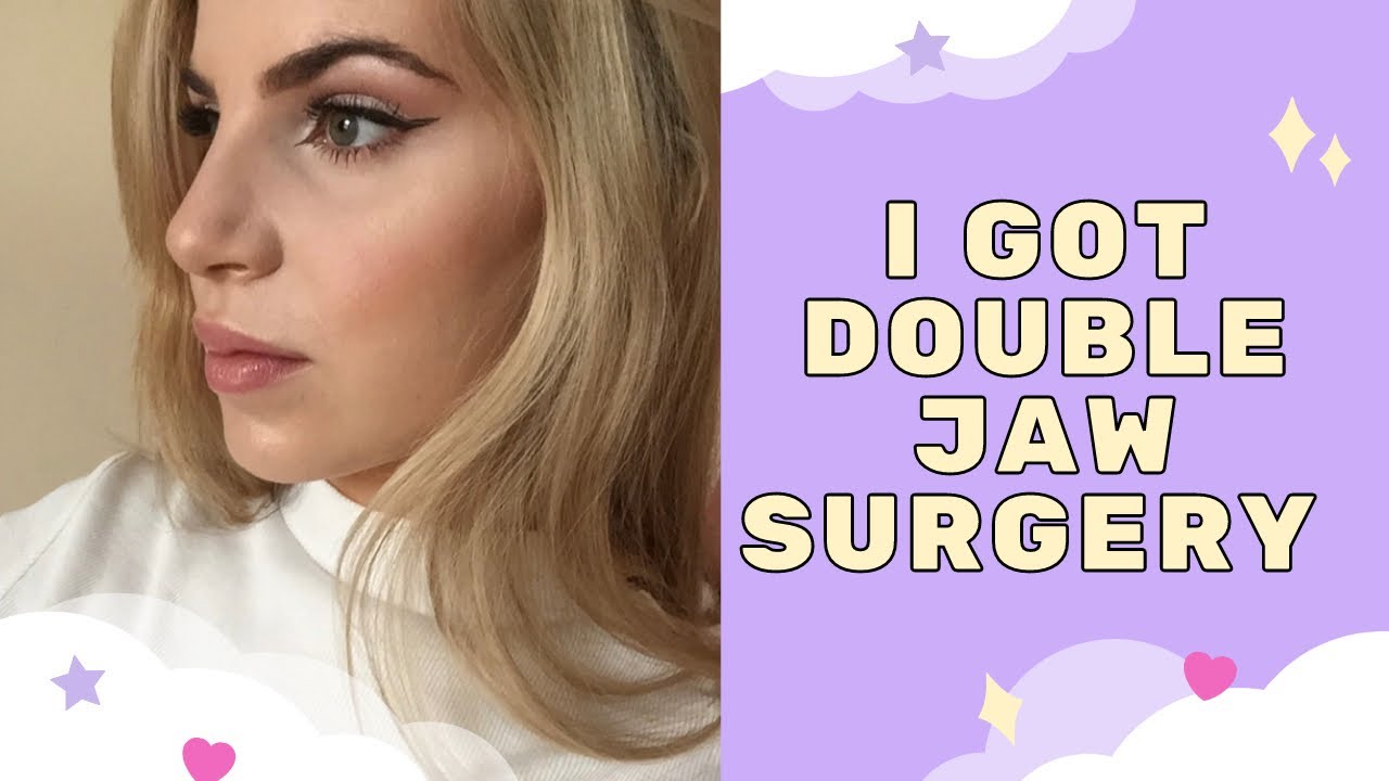 STORY TIME: WHEN I GOT DOUBLE JAW SURGERY!!