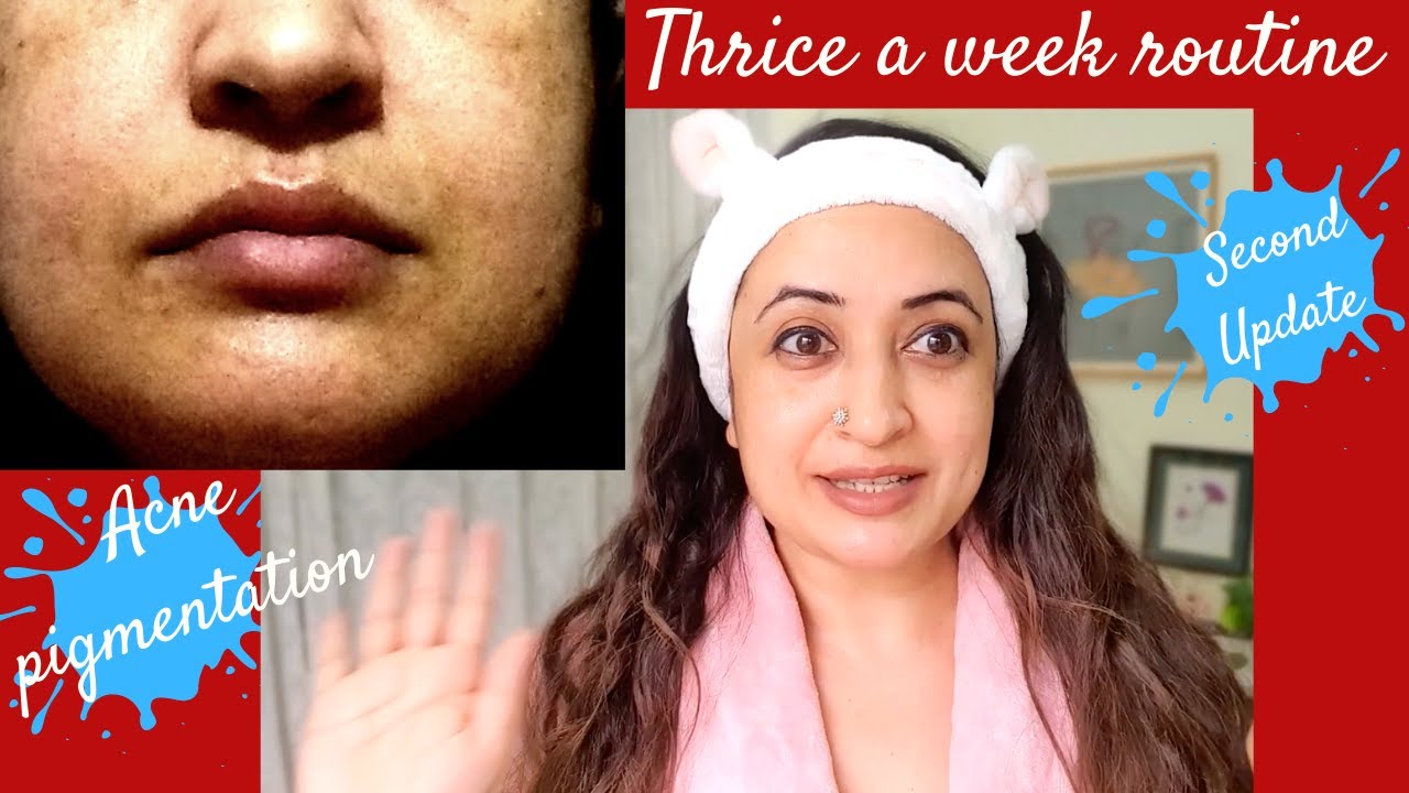 My Detailed UPDATED Summer AM/PM Skincare Routine- Fading Pigmentation, Acne Scars | Second Update