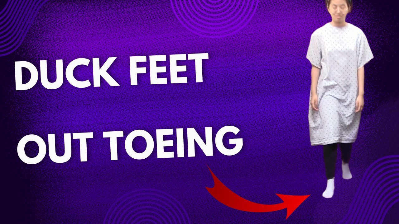 Duck Feet, Duck Toe, Out Toeing HELPED by Dr Suh Chiropractic