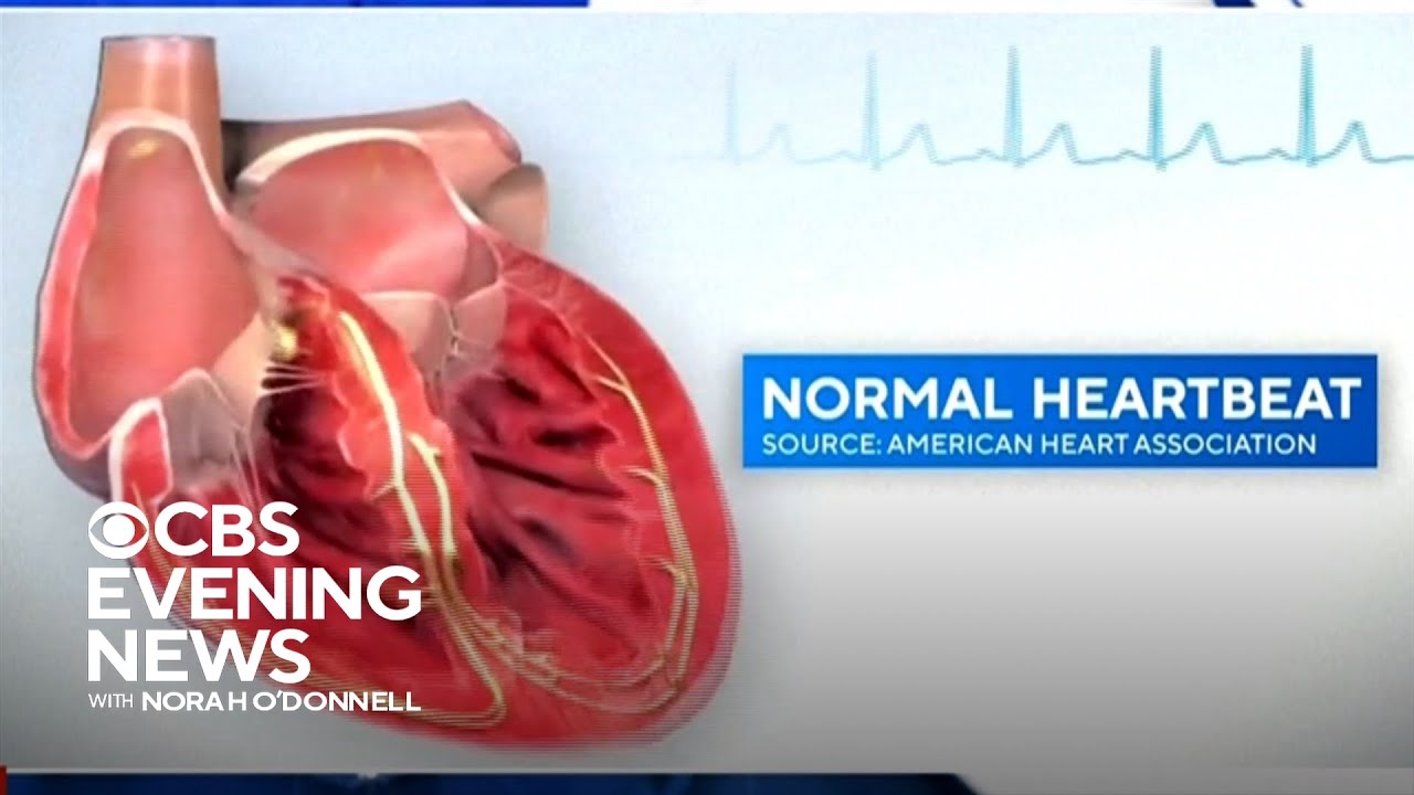 What could have caused Damar Hamlin's cardiac arrest?