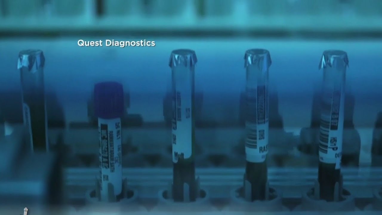 Waiting period for covid-19 test results vary