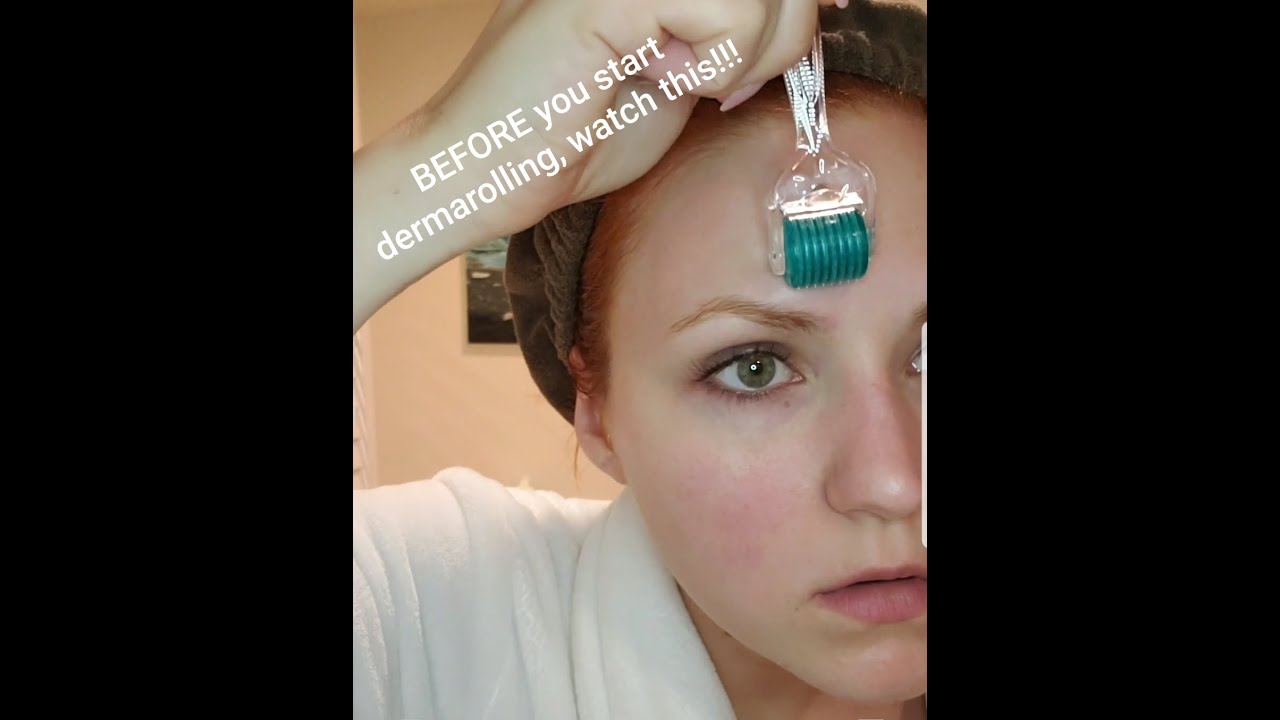 BEFORE you start dermarolling, WATCH THIS!!!