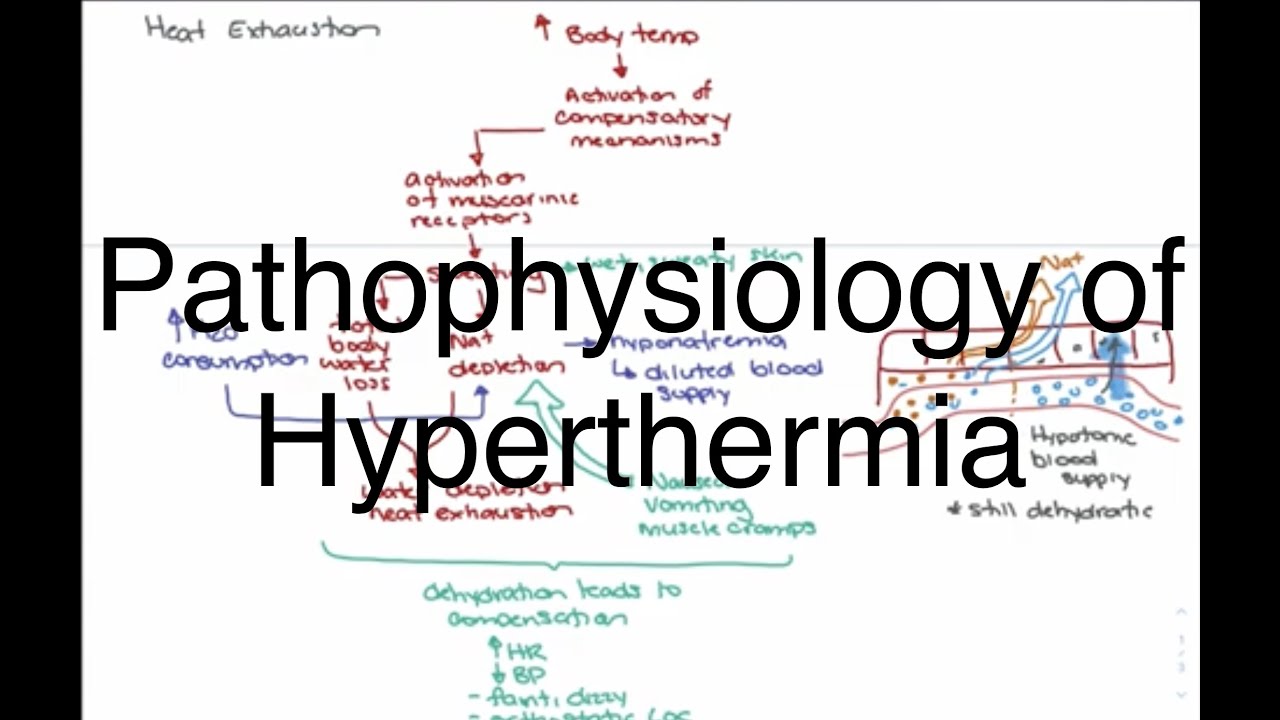 Hyperthermia Pathophysiology