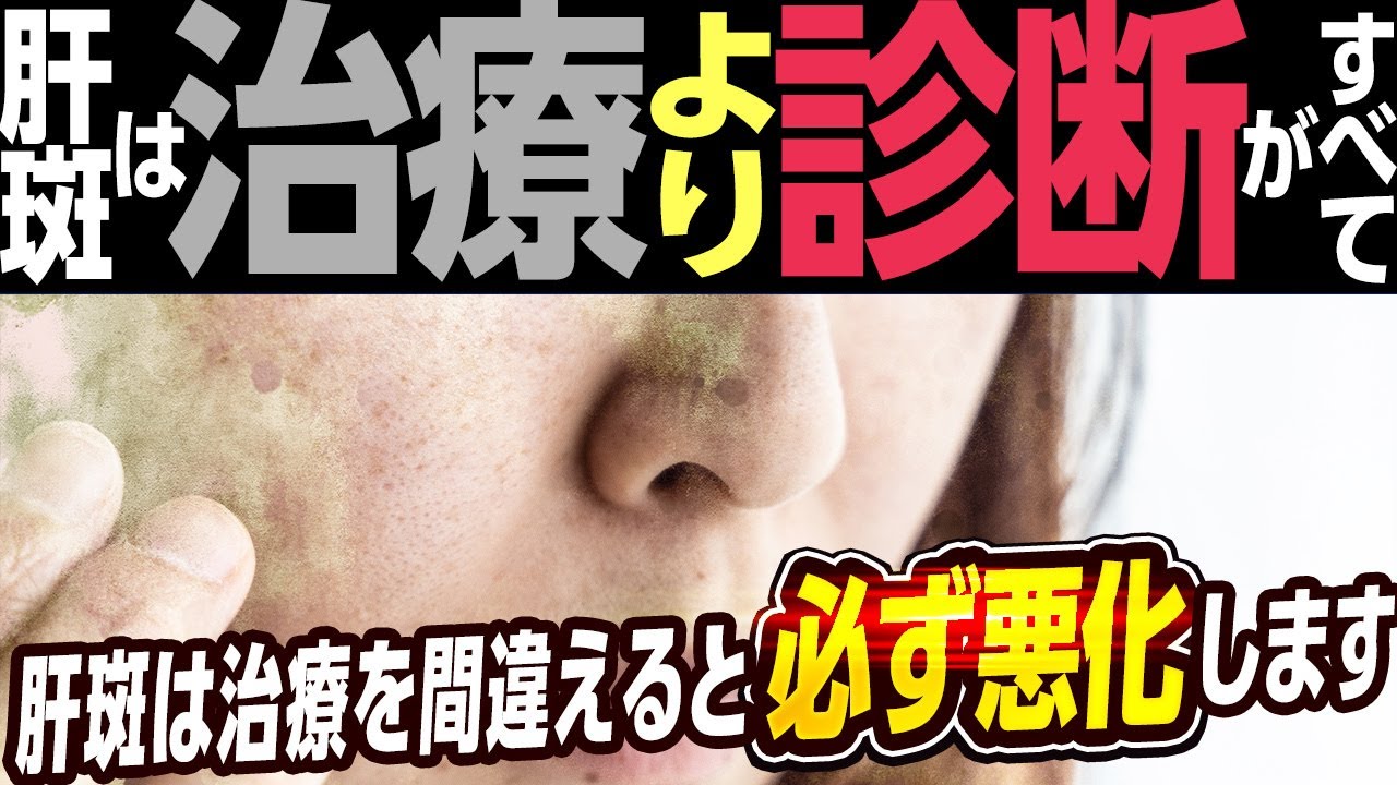 【医師解説】肝斑の真実｜悪化する人の共通点と“正しい治療順番”を徹底解説します