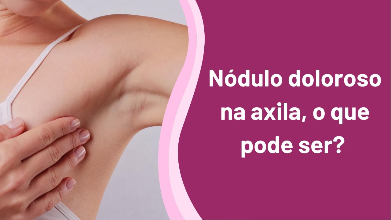 Tenho um nódulo doloroso na axila, o que pode ser?
