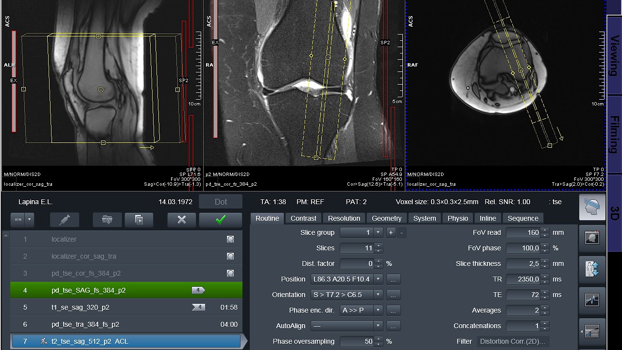 MRI planning Knee