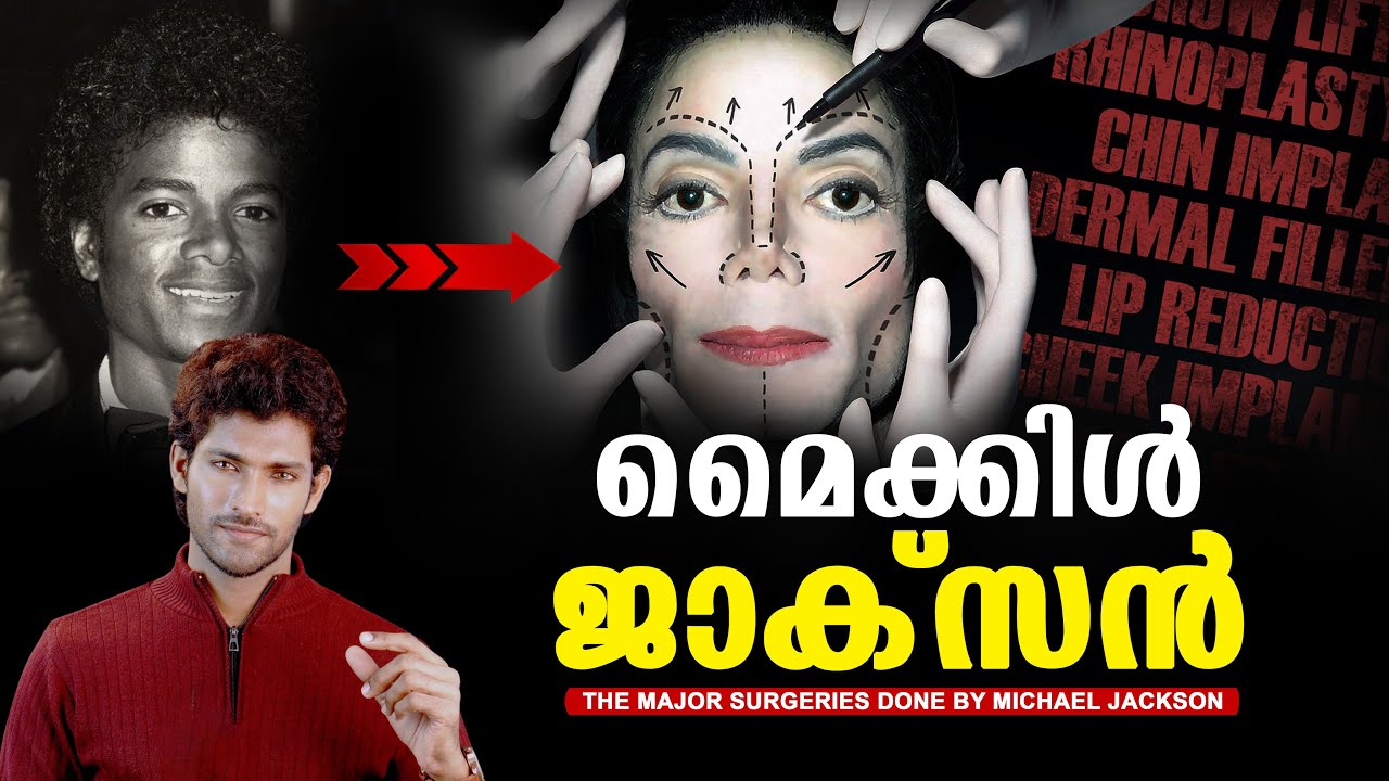 MICHAEL JACKSON | Face Transformation | Plastic Surgery Failure