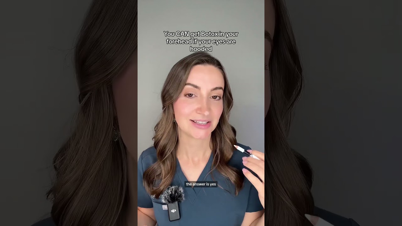 Hooded eyes Part 2 | How to fix them & Botox with hooded eyes