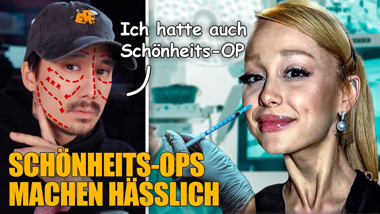 Wann gehen Schönheits-Ops zu weit? 💉
