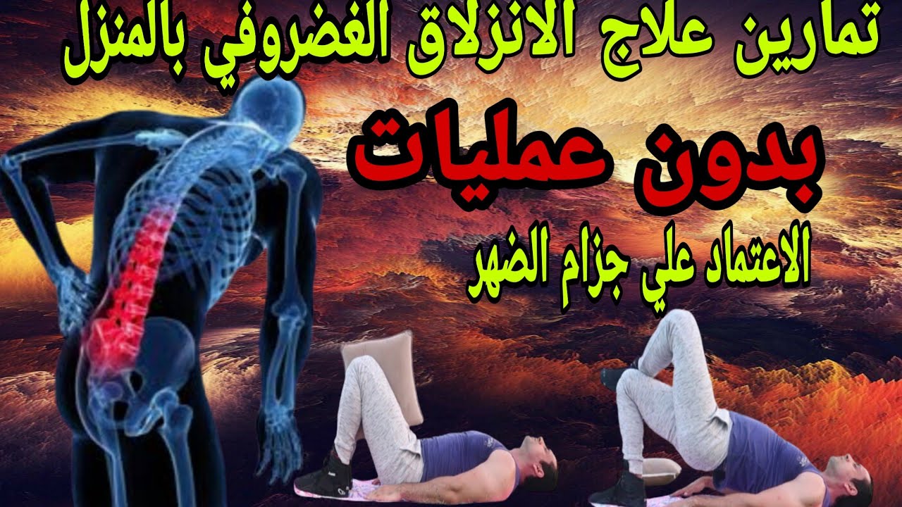 تمارين الانزلاق الغضروفي البسيطة | إزاي تبدأ بأمان من غير ما تزود الألم؟ (الجزء الأول) .