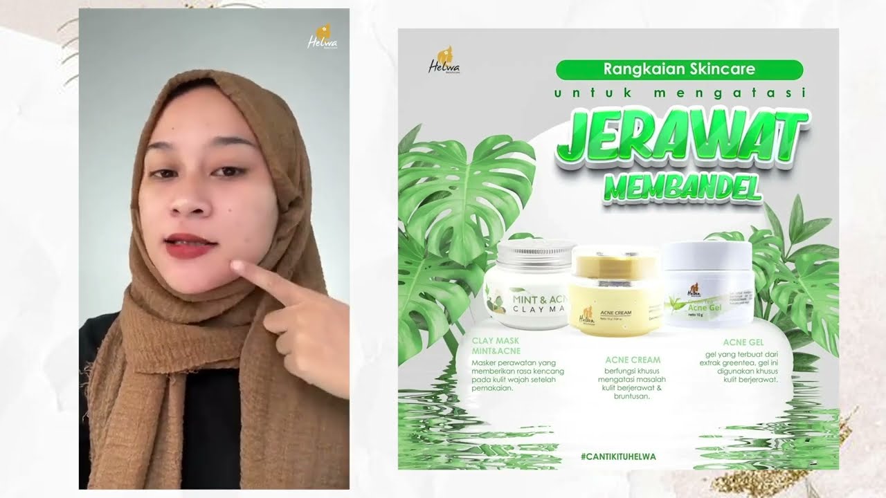 Testimoni Acne Gel - Helwa Beautycare