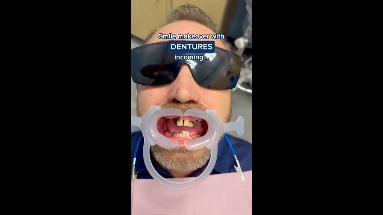 Watch AJ Get His Smile Back With This Incredible Denture Transformation