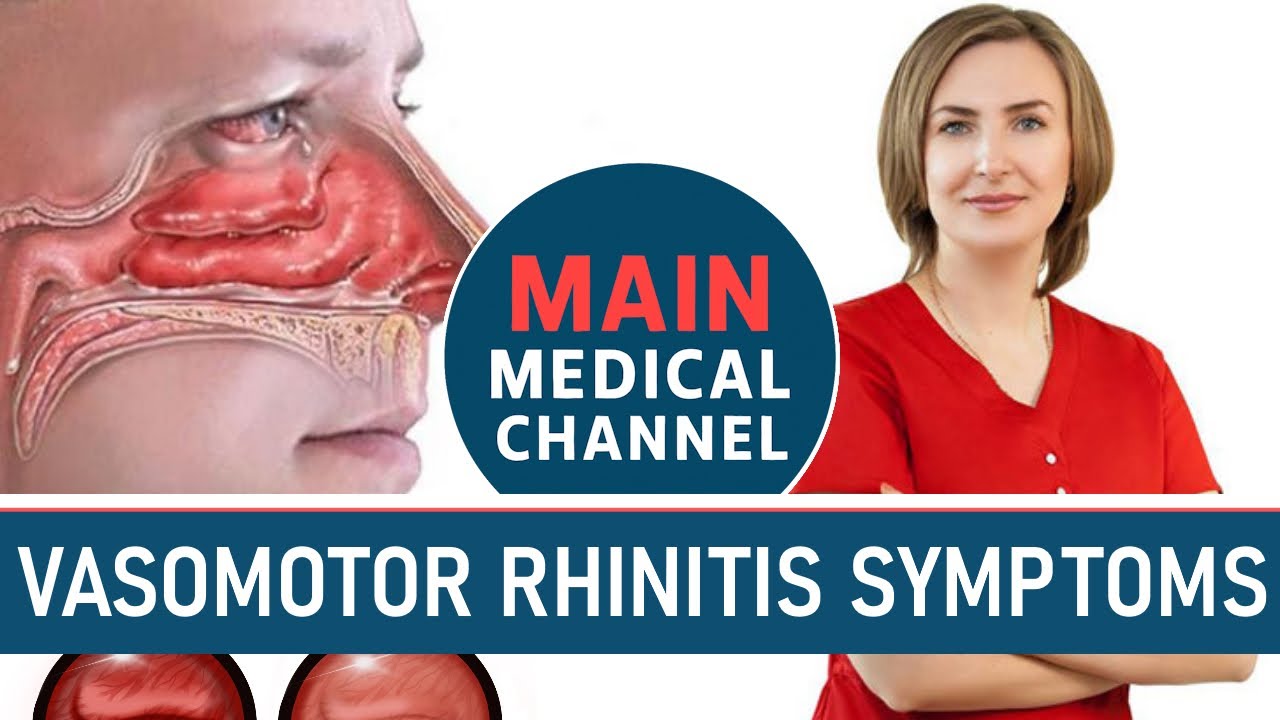 Vasomotor Rhinitis: Symptoms and Causes. Chronic runny nose