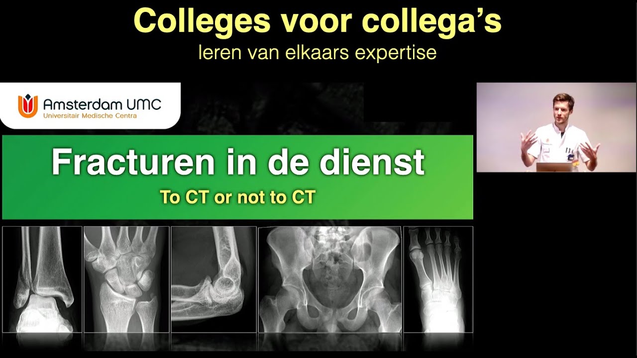 Colleges voor collega's - Fracturen in de dienst