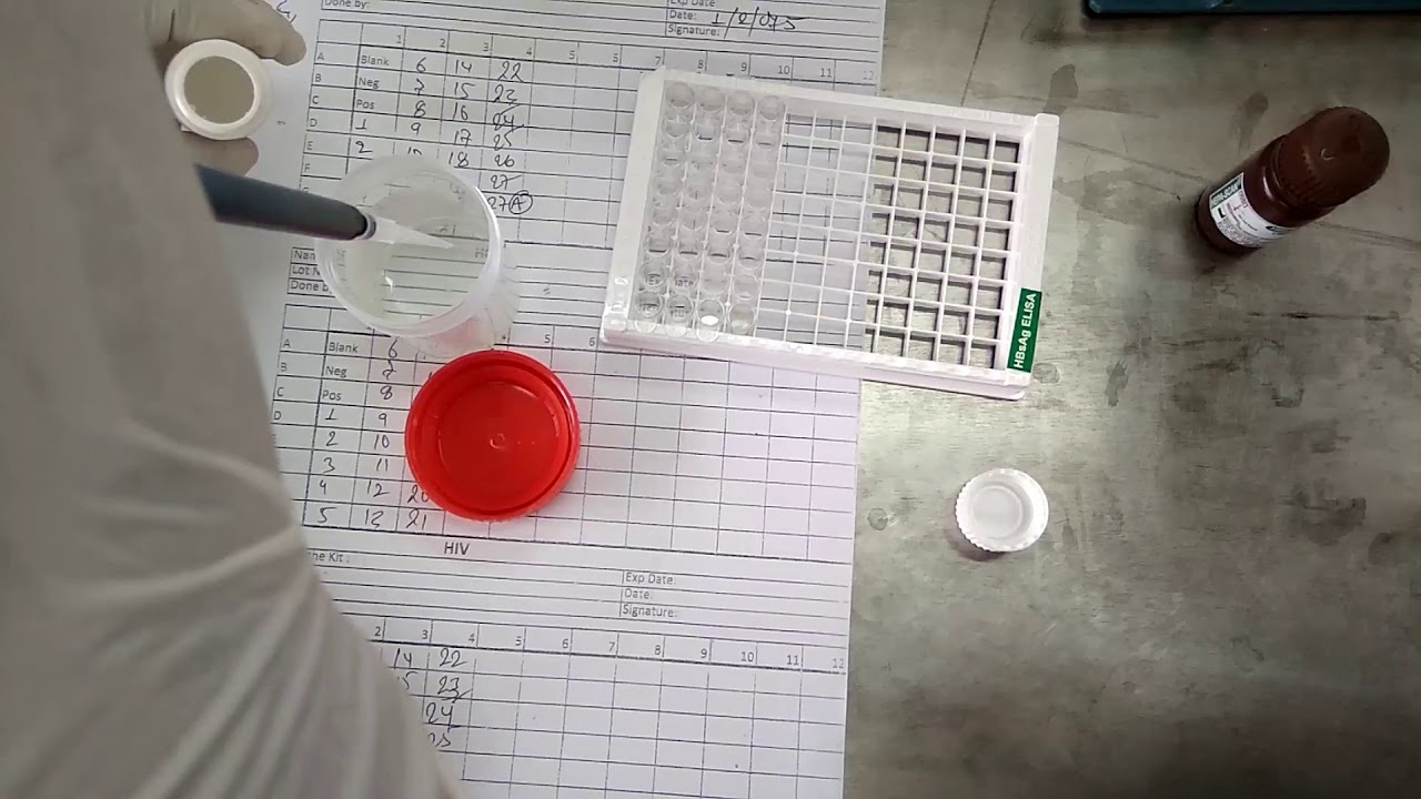 HBsAg ELISA  test procedure