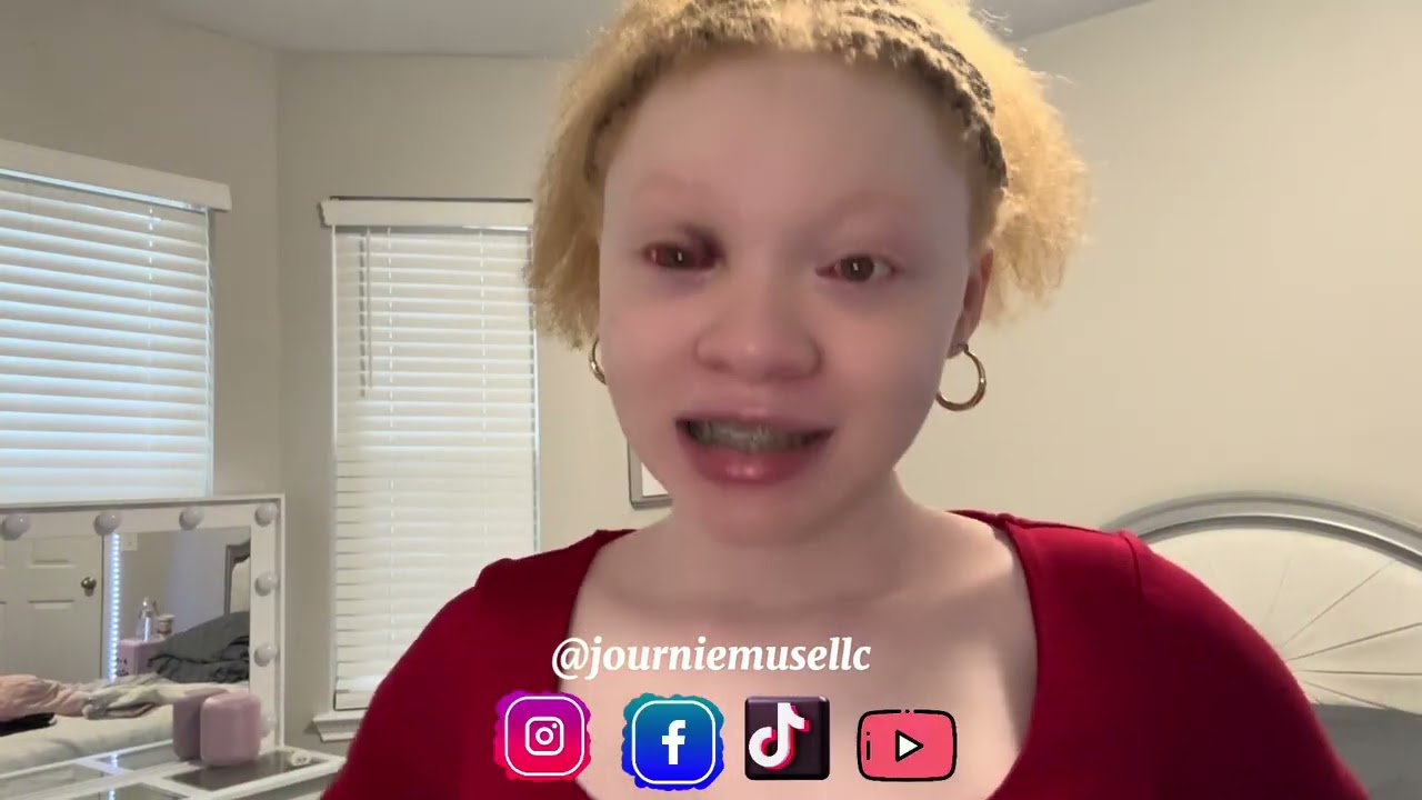 Episode 4: Post-Op Results 👁️