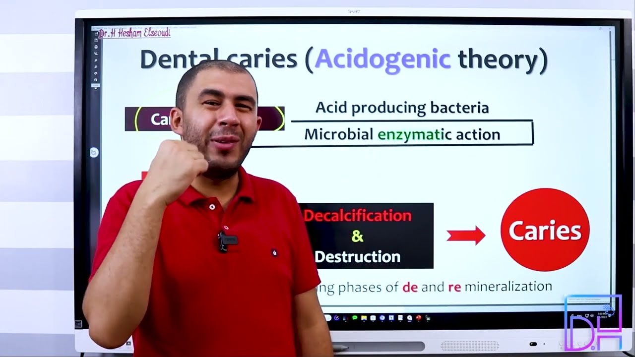 5- Dental Caries Definitions and theories - كل ما يخص تعريف ونظريات التسوس وأنواعه