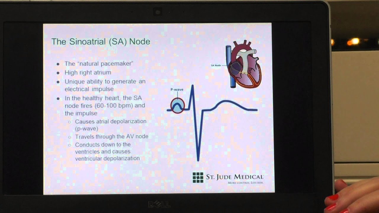 SA Node - Sinoatrial Node