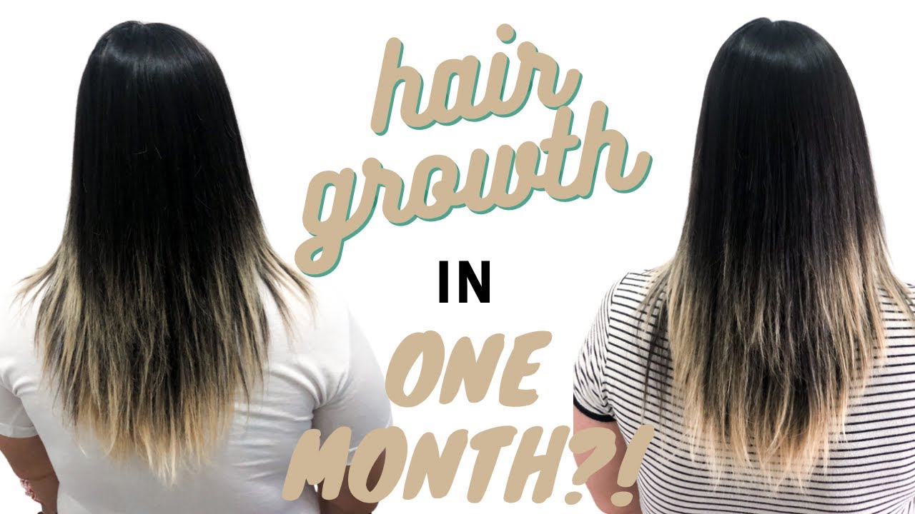 Honest 1 Month BondiBoost Hair Growth Update | My Hair Loss Journey