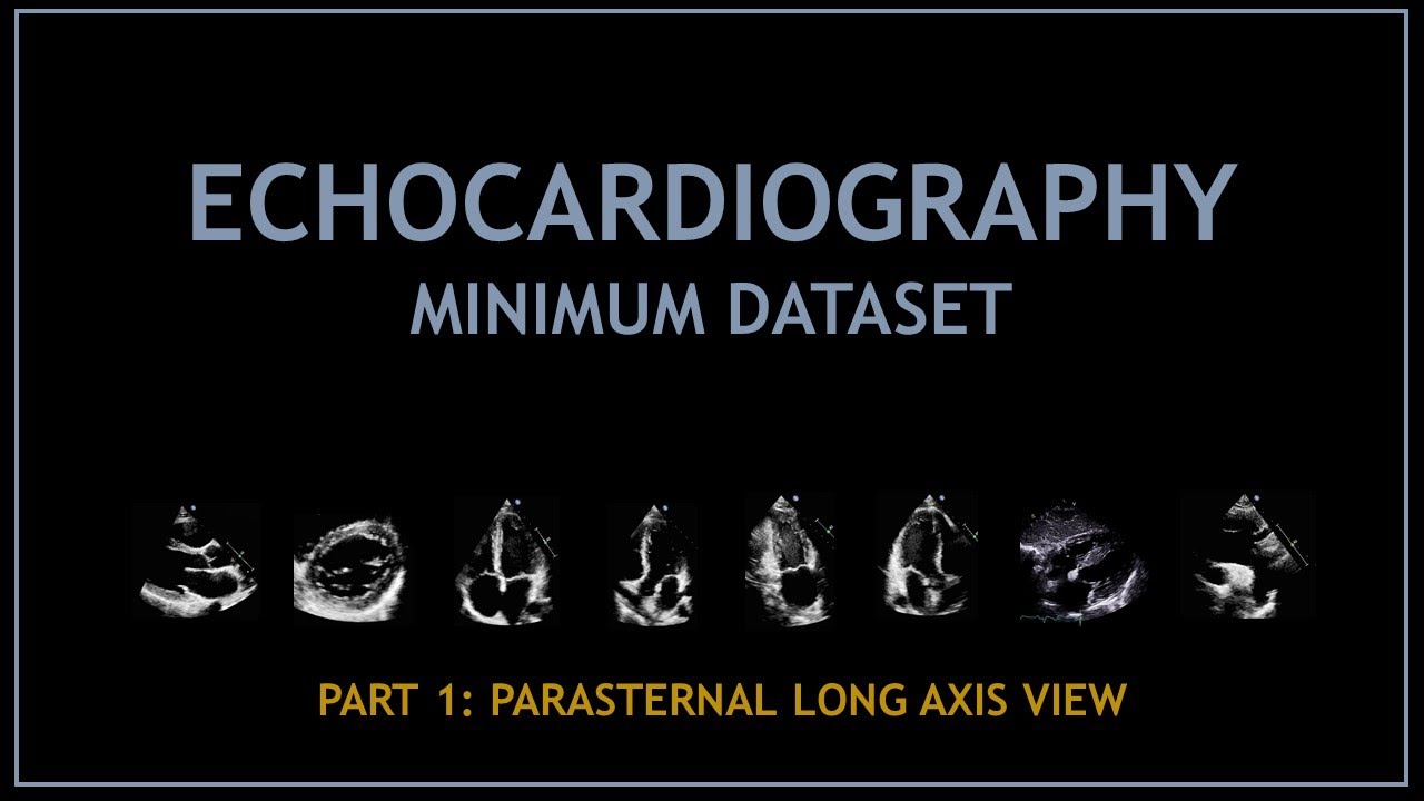 Echocardiogram: Minimum dataset (PART 1: parasternal long axis view)