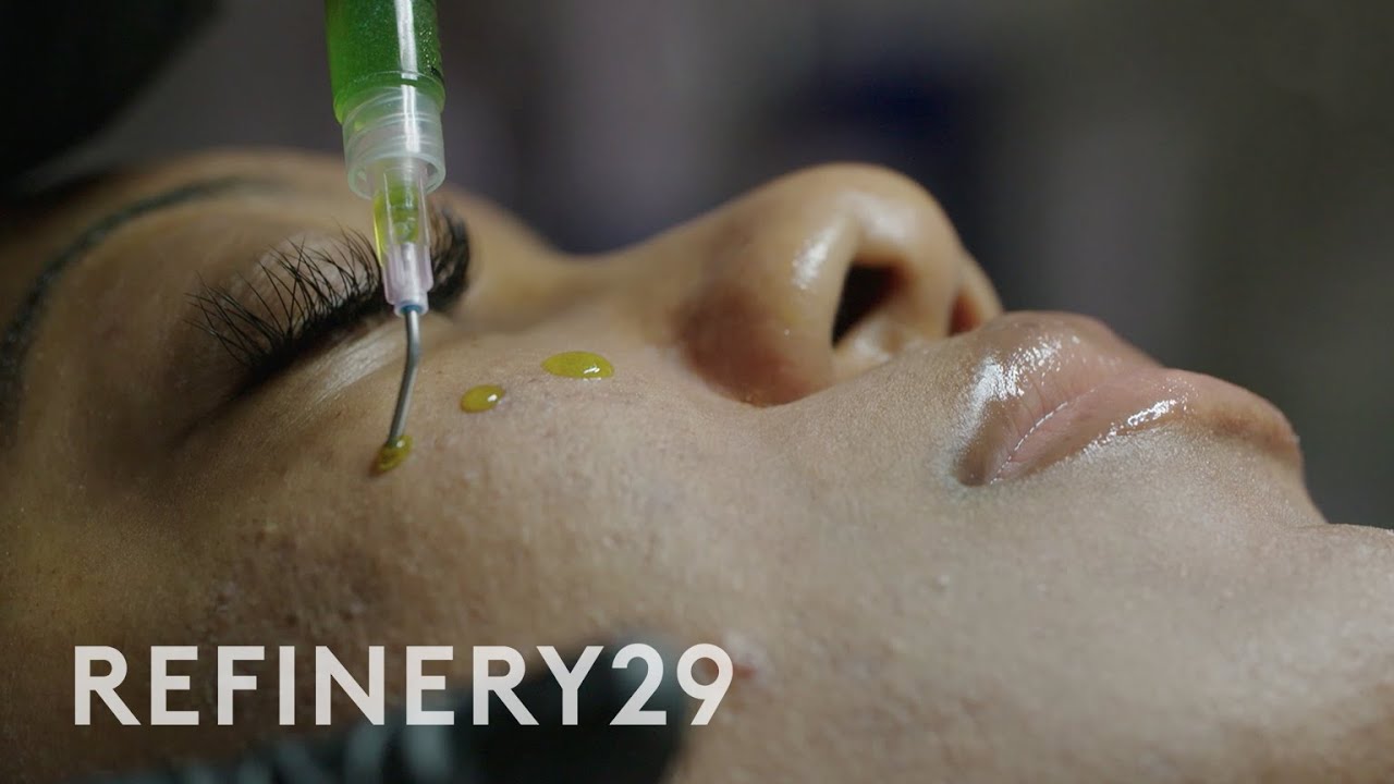 Я попробовала химический пилинг для «стеклянной кожи»: BioRePeel | Macro Beauty | Refinery29