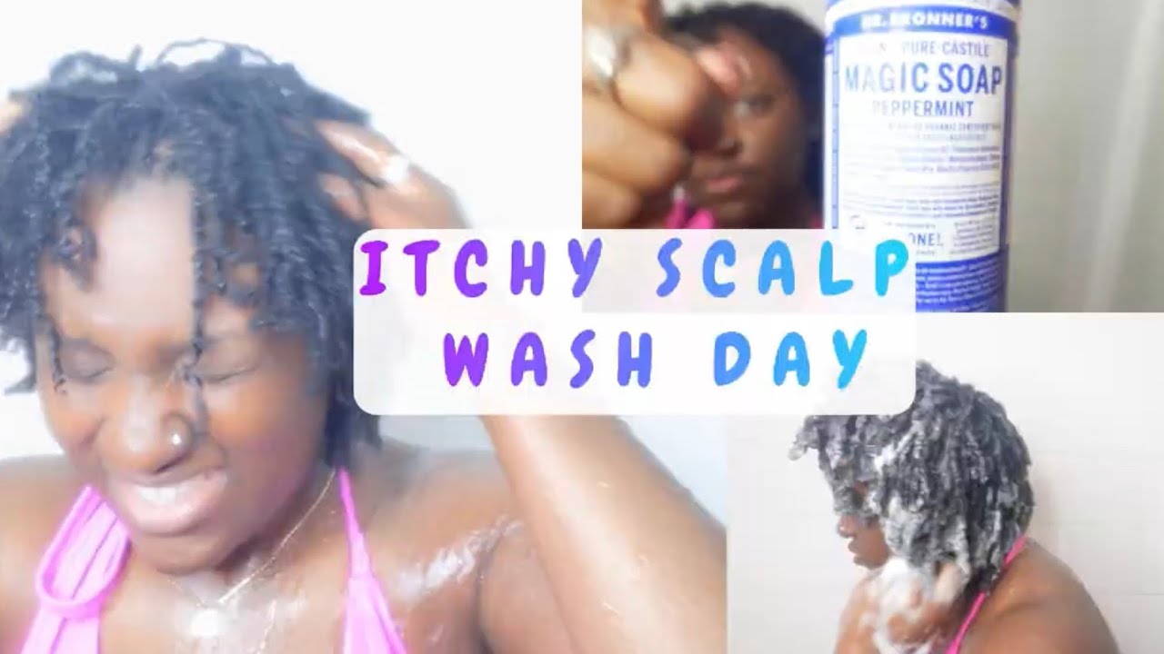 ITCHY SCALP | SIMPLE WASH DAY | QUIET | MICRO LOCKS 