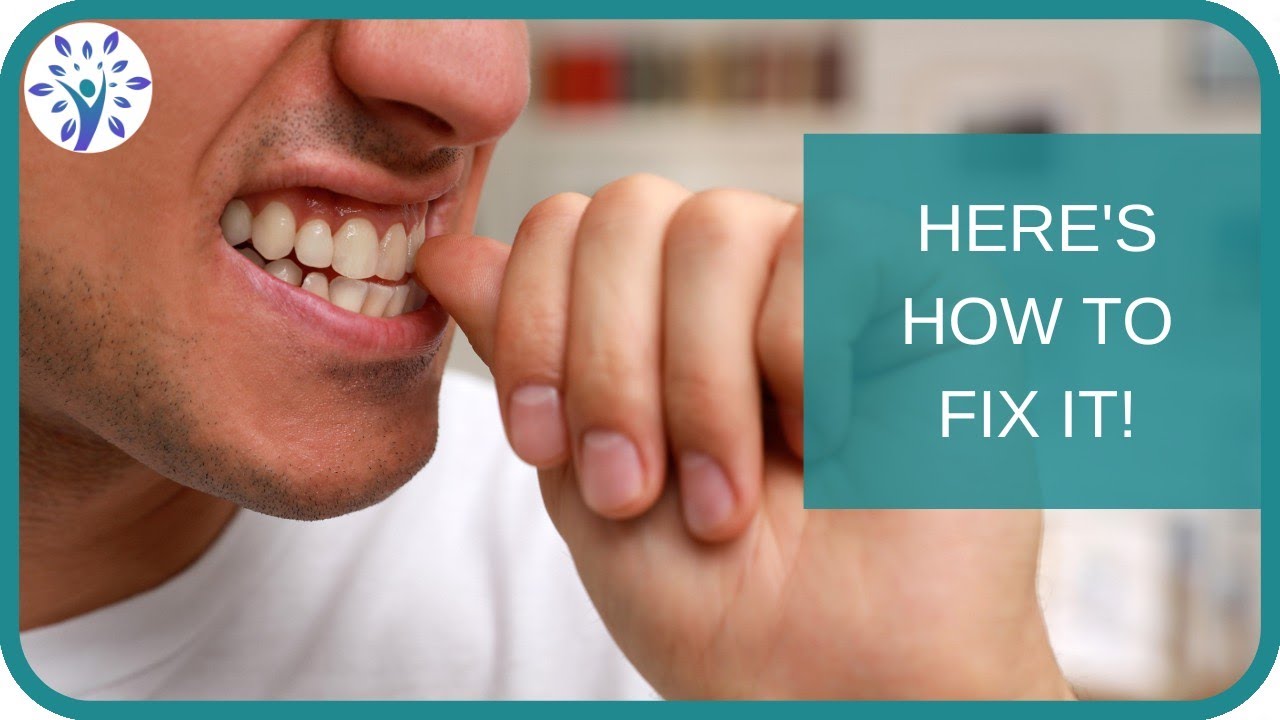How to Fix a Broken Habit  | Re-build Positive Habits!