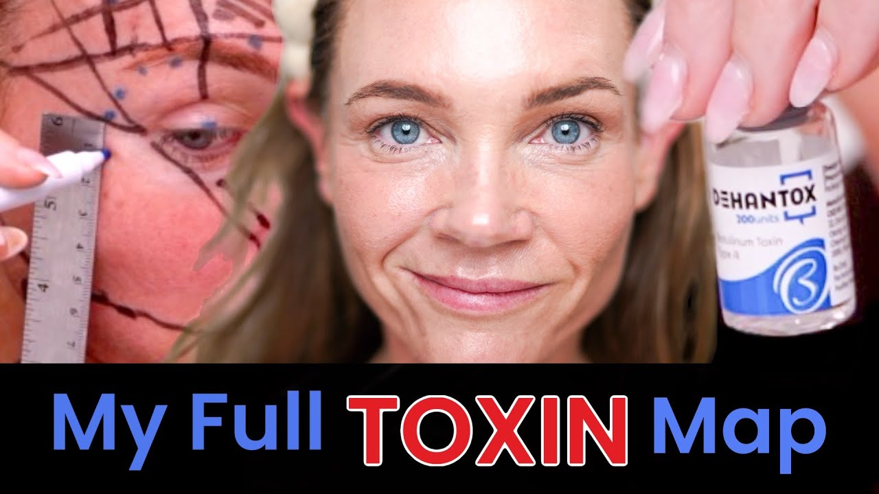 My 200-Unit Dehantox Face Map &mdash; Why I Placed Every Unit (Educational, Not Instruction)