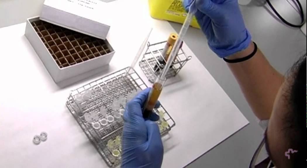Protocolo de recogida y procesamiento de muestras sanguíneas STR01
